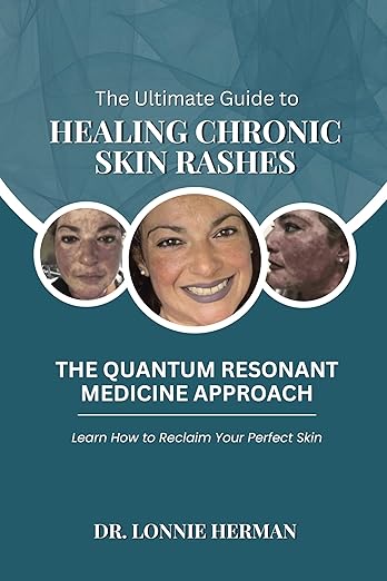 Free: The Ultimate Guide To Healing Chronic Skin Rashes